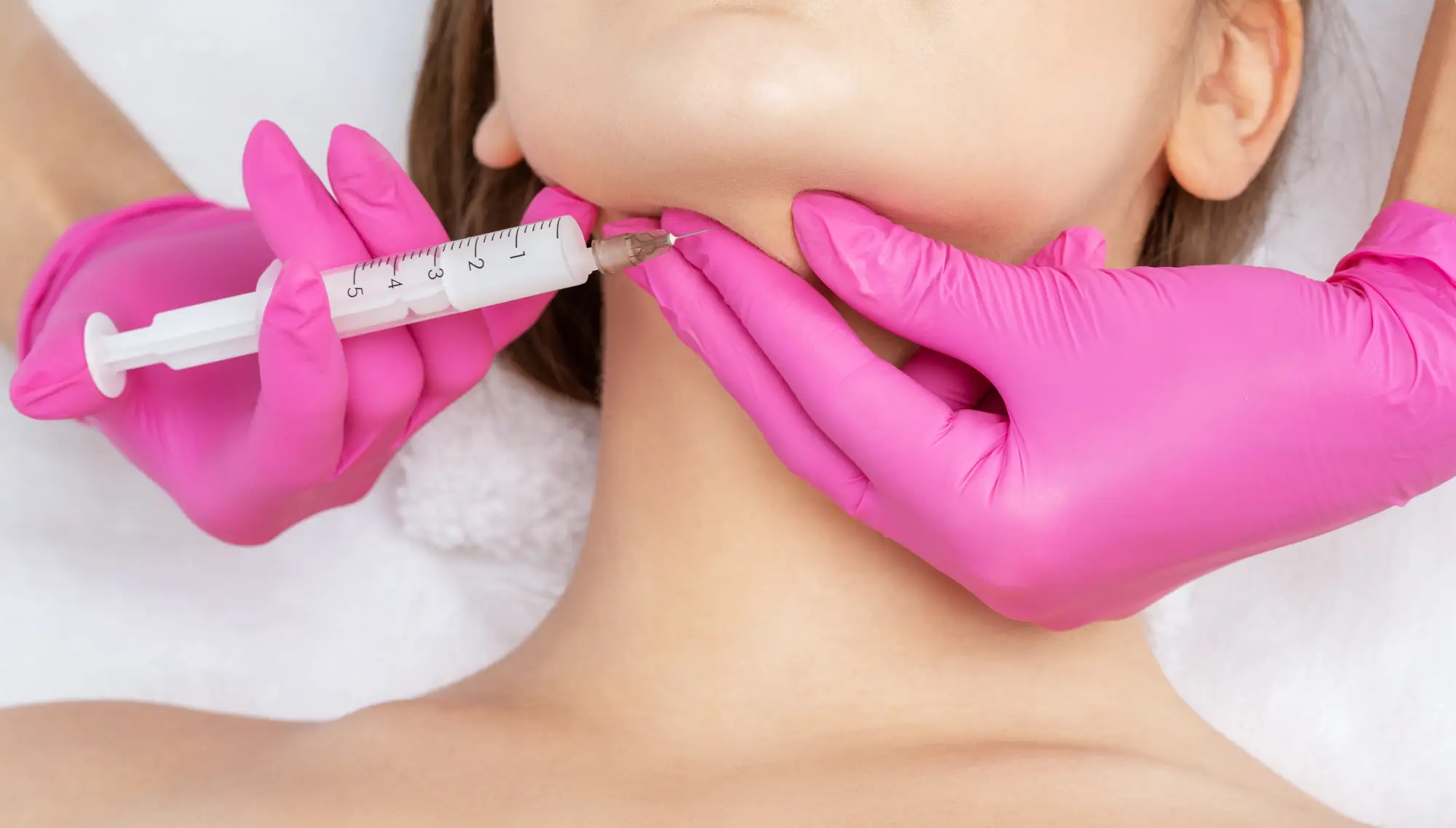 a person getting a Radiesse injection in Cary, NC
