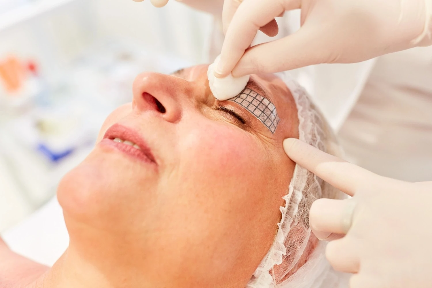 A woman getting Thermage FLX Eye Treatments in Cary, NC