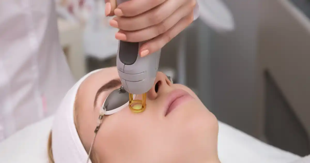 Laser Treatment for Your Skin Type in Cary, NC