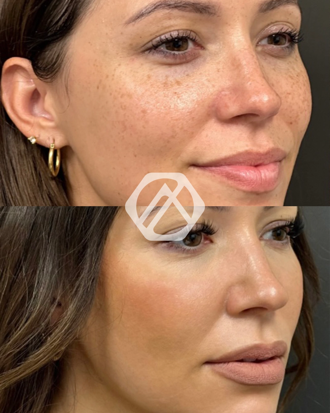 Facial Balancing