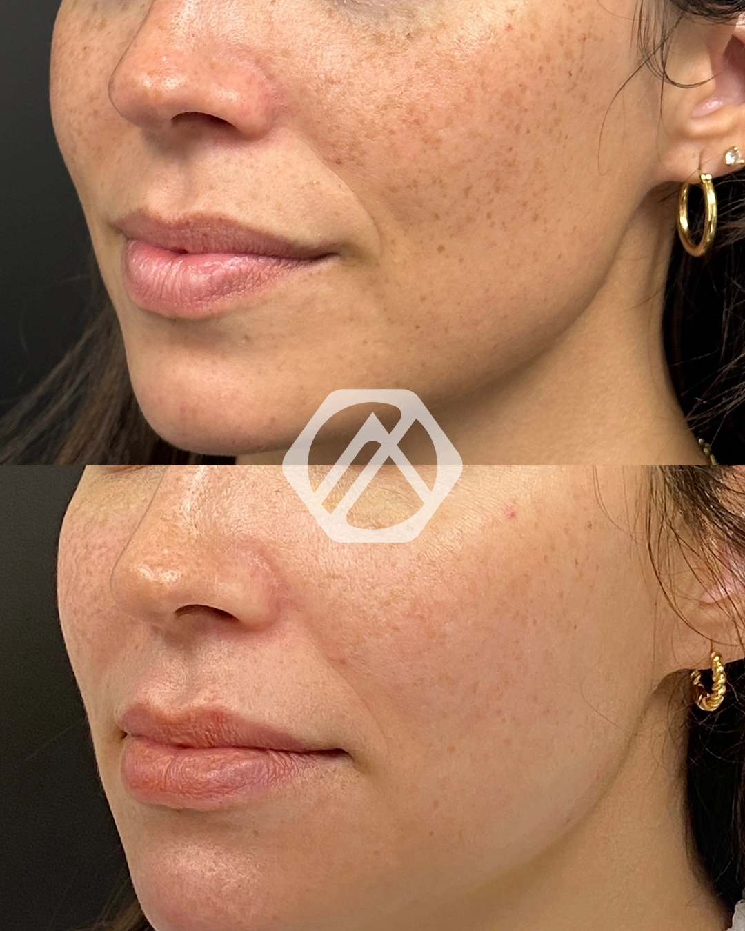 Facial Balancing