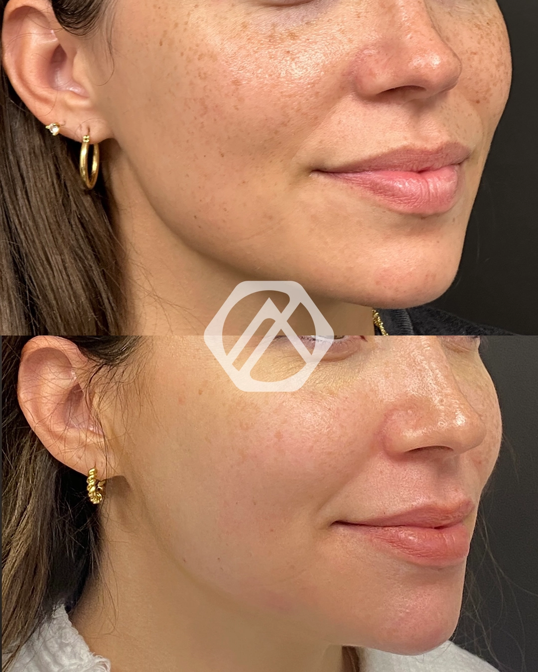 Facial Balancing