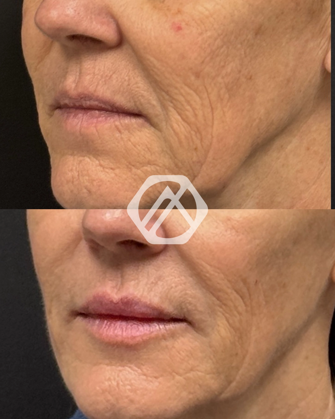 Facial Balancing