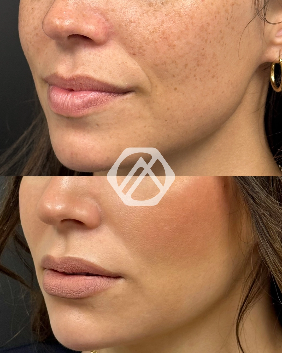 Facial Balancing