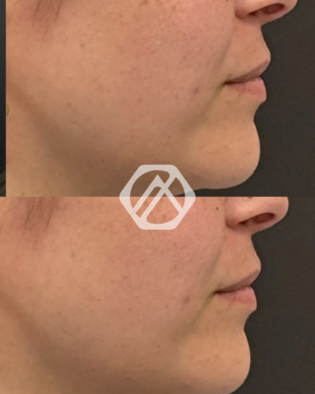 Facial Balancing