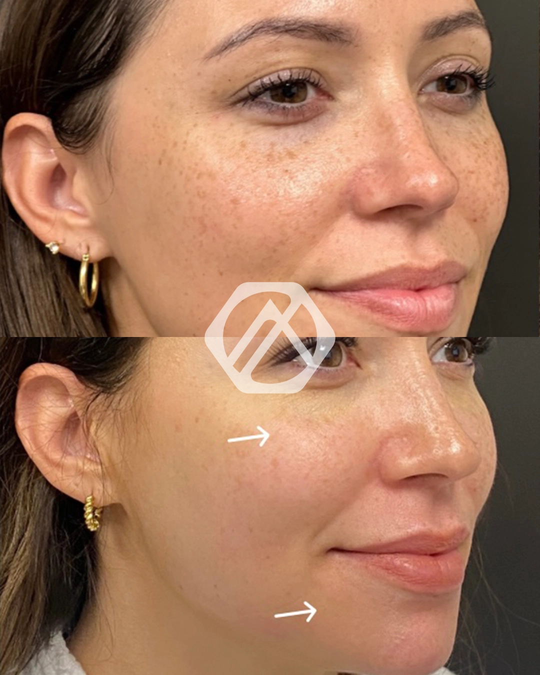 Facial Balancing