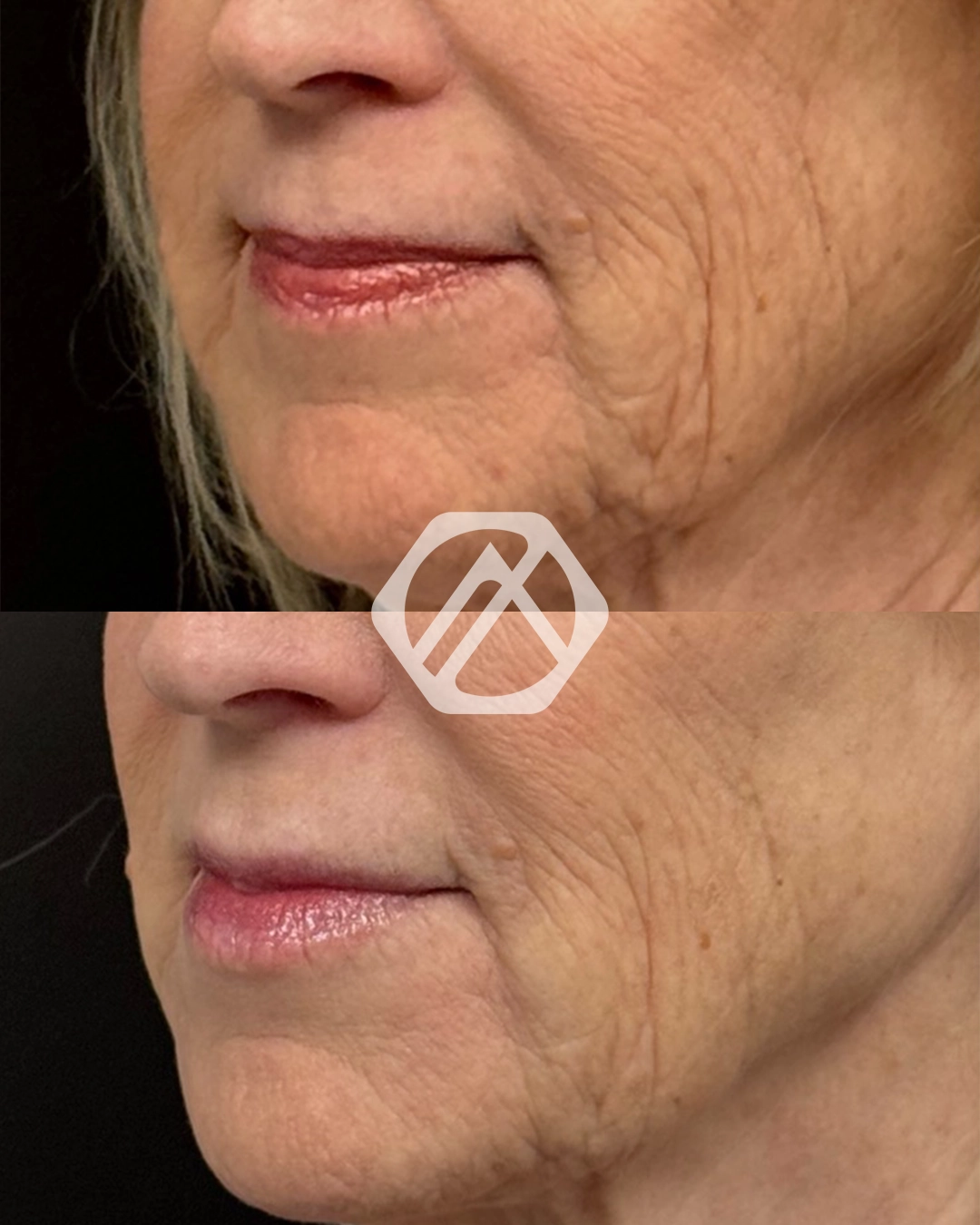 Facial Balancing