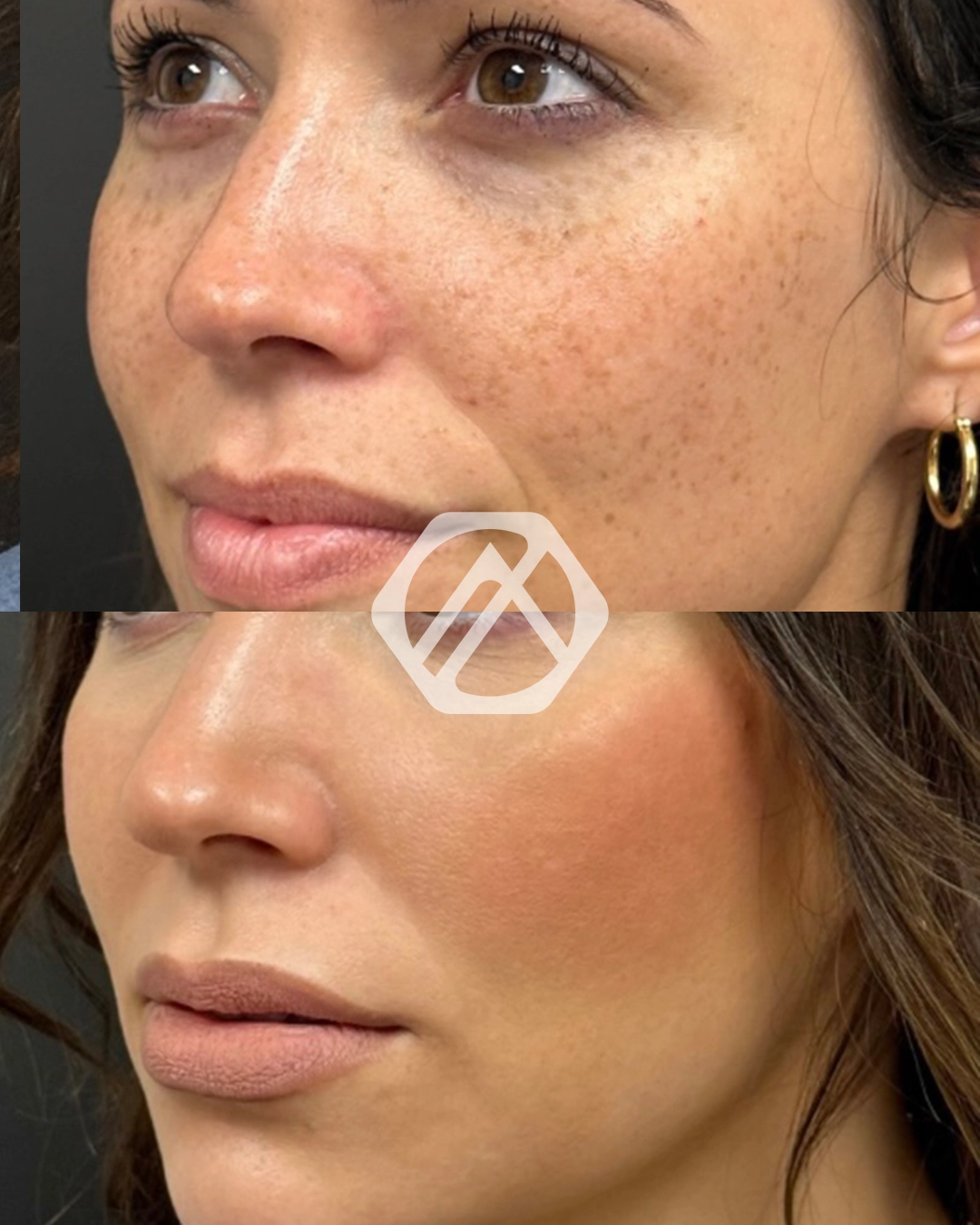 Facial Balancing