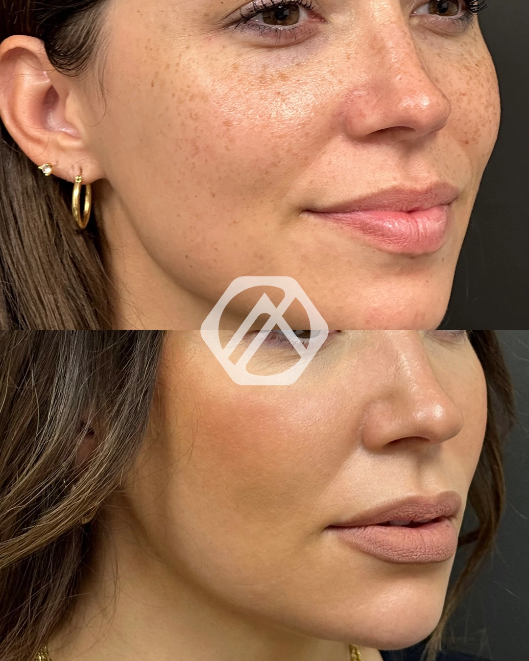 Facial Balancing